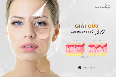 Bổ sung collagen chống lão hóa da tuổi 30 - SkinLift Collagen