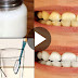 She Whiten Teeth Within 10 Minutes By Using This Method!