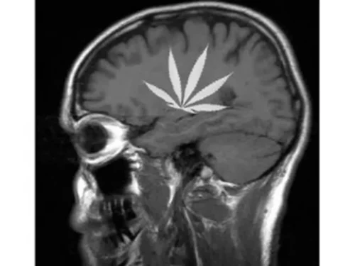 medicalmarijuanabrain