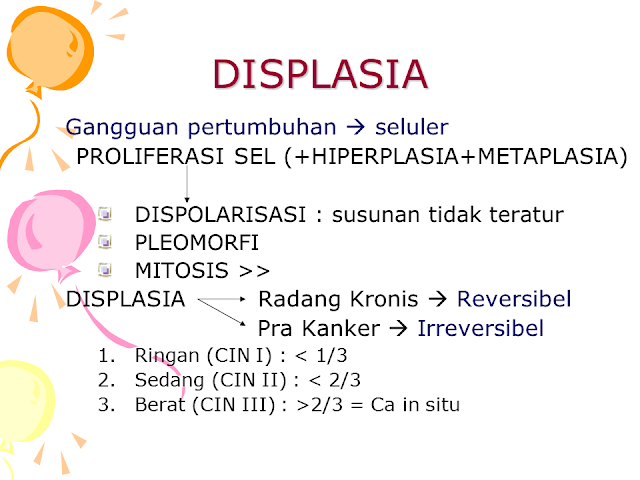 Displasia