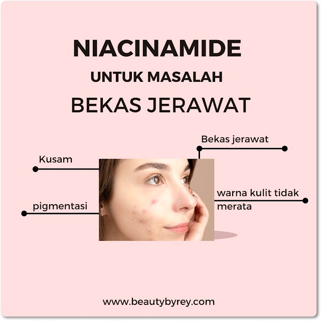 kulit kusam pakai skincare apa