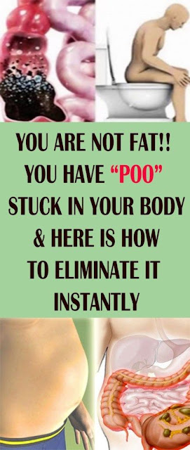 You Are Not Fat!! You Have “POO” Stuck In Your Body & Here Is How To Eliminate It Instantly