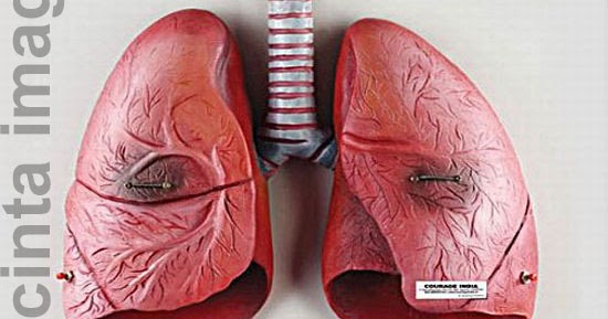 Cintaimaginasi: COPD Penyakit Paru-Paru Kronik