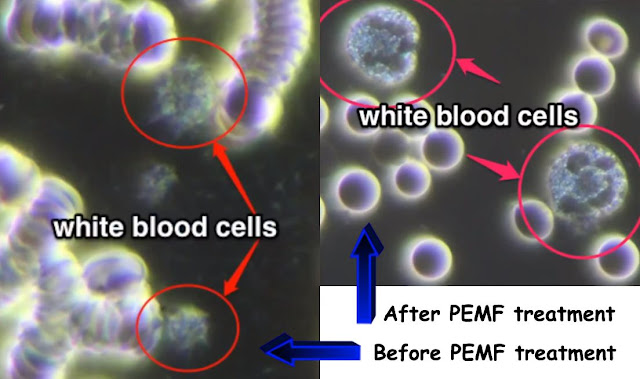 PEMF DEVICE And Blood