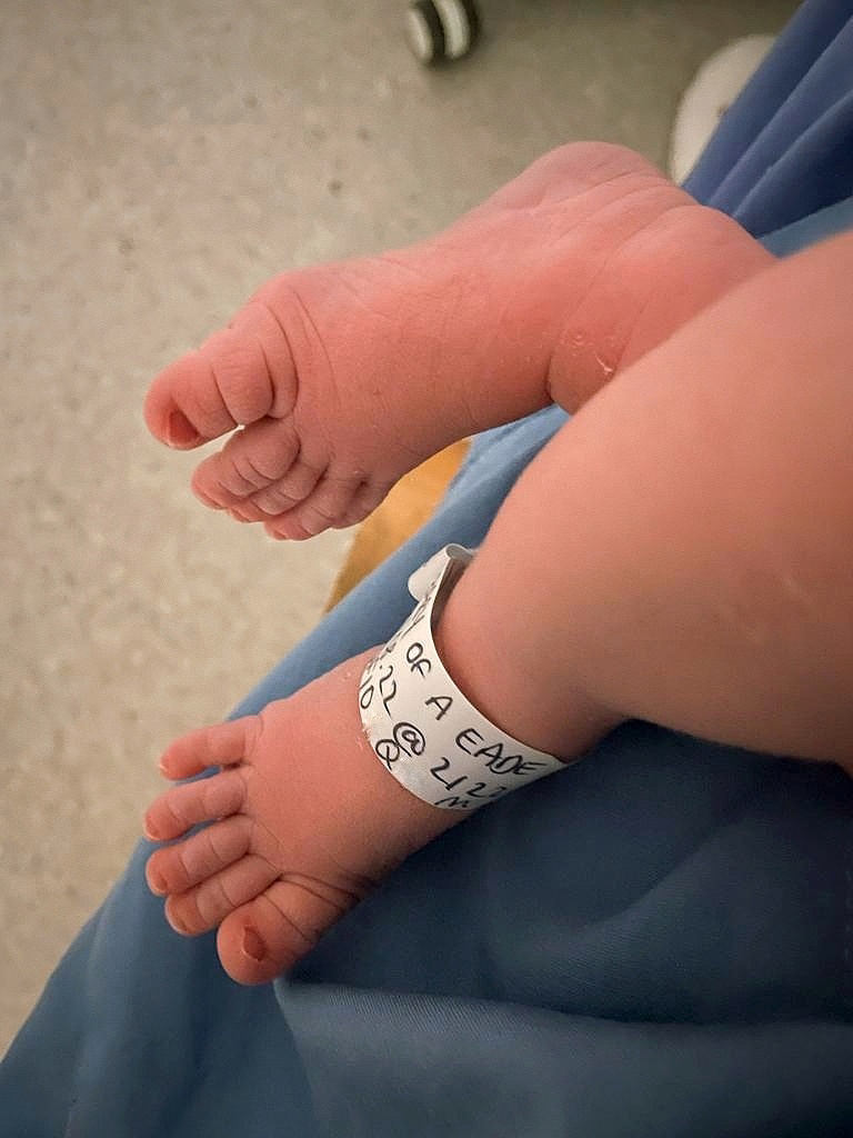 a newborn baby's feet with a hospital band round one ankle
