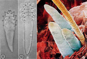 Demodex podle zdroje http://coo.fieldofscience.com/2008/04/your-little-friends-that-are-with-you.html