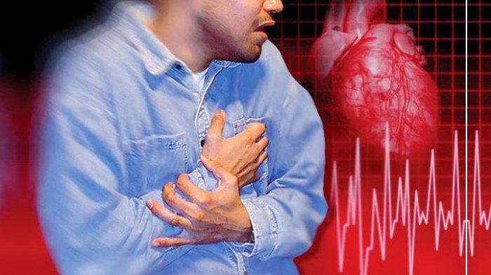 Memahami Tanda-tanda Munculnya Serangan Jantung