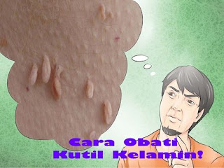 Obat kutil kelamin bagus, bagaimana cara menghilangkan kutil kelamin atau kutil di kemaluan, obat herbal kutil kelamin terbaik, obat kutil kelamin atau kutil di kemaluan ketika hamil, kutil di daerah kemaluan, cara mengobati kutil kelamin atau kutil di kemaluan, obat kutil kelamin yg tersedia di apotik, obat kutil kelamin di bandung, cara menghilangkan kutil kelamin atau kutil di kemaluan dengan bawang putih, cara menghilangkan kutil di kelamin pria, kutil di batang kemaluan