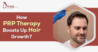 PRP for Hair Loss | Hair Therapy Treatment