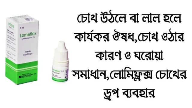 চোখ উঠলে বা লাল হলে কার্যকর ঔষধ,চোখ ওঠার কারণ ও ঘরোয়া সমাধান,লোমিফ্লক্স চোখের ড্রপ ব্যবহার