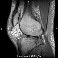 Ronaldo Quadriceps on Dr  Marcos Britto Da Silva   Ortopedista Traumatologia E Medicina