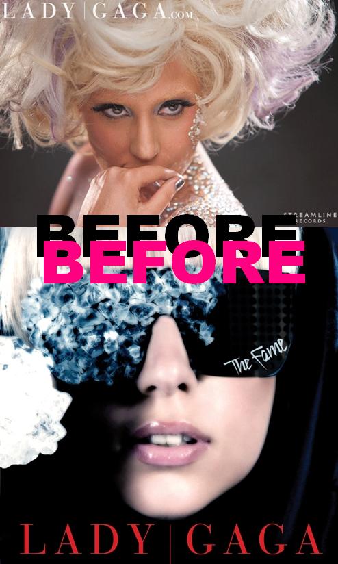 lady gaga nose surgery