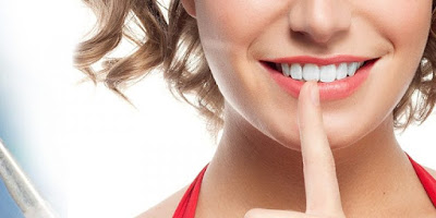 Bọc răng sứ mất bao lâu? Bác sĩ tư vấn nhanh-2