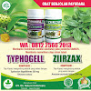 Sakit Payudara Sebelah Kiri Bagian Samping Saat Menyusui / Obat Di Apotik Buah Zakar Besar Sebelah - Home / Wanita yang telah melakukan operasi pada payudara, rasa sakit dari pembentukan jaringan parut dapat bertahan lama setelah sayatan sembuh.