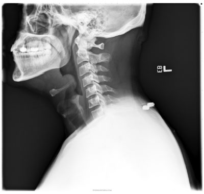 Cool X-Ray Video of What