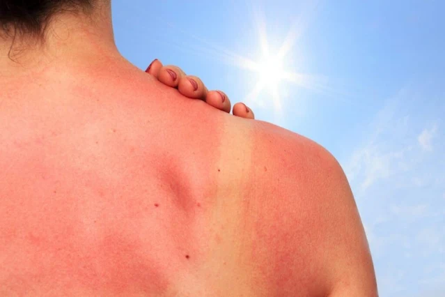 Everything You Need to Know to Avoid Sun Damage WITHOUT Using Cancer-Causing Sunscreen