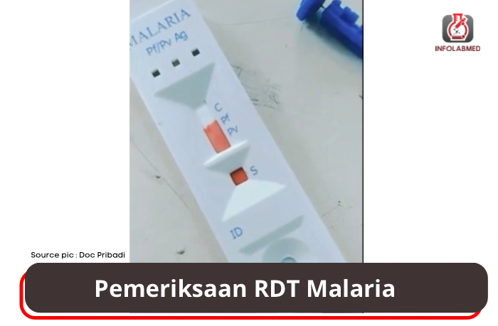 Pemeriksaan RDT (Rapid Diagnostic Test) Malaria