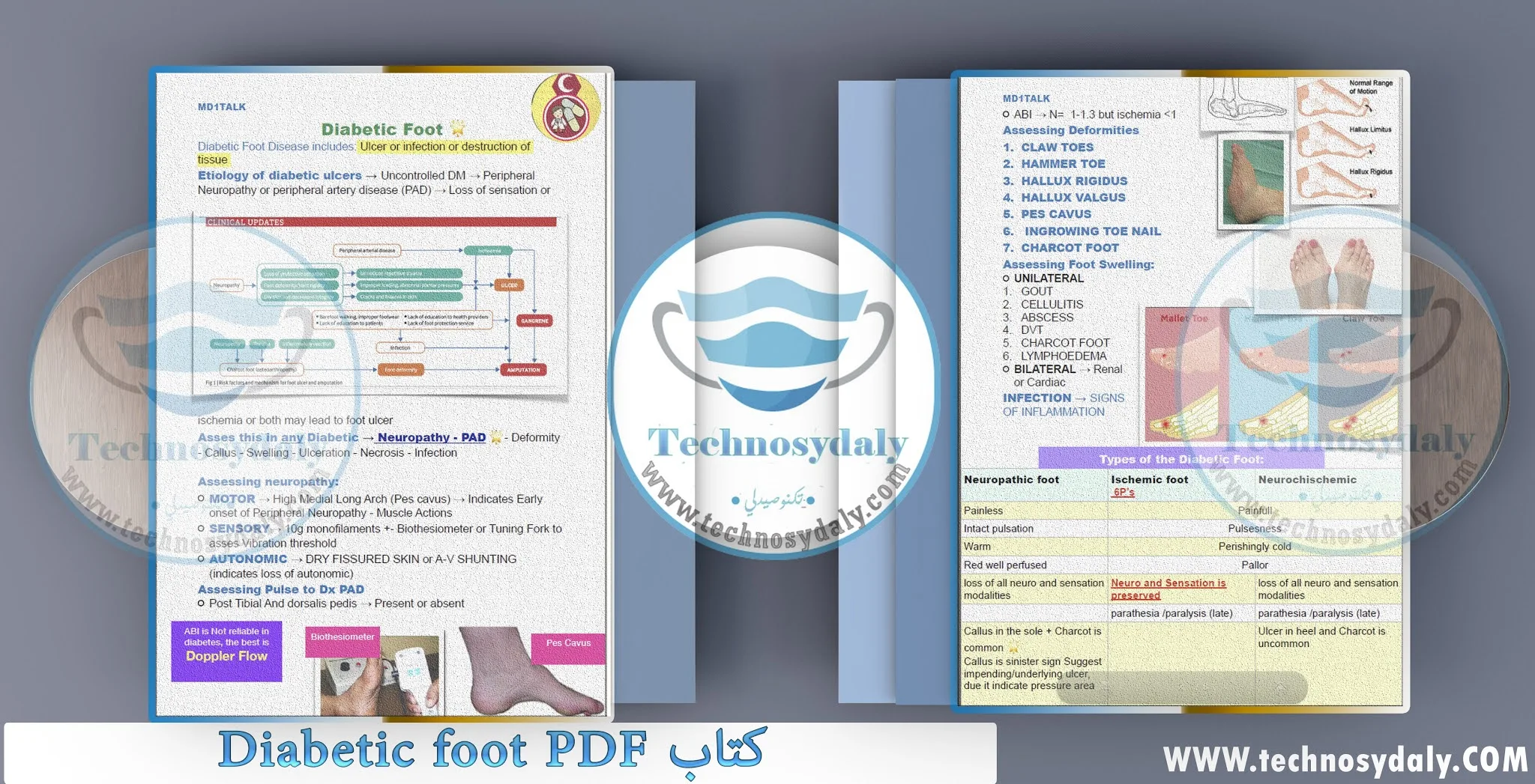 كتاب Diabetic foot PDF