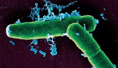 #Antraz, Bacillus Anthracis (Anthrax)