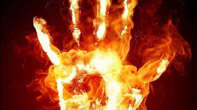 लिविंग में रह रहे पार्टनर को जिंदा जलाने का किया प्रयास, पाटर्नर की हालत गंभीर
