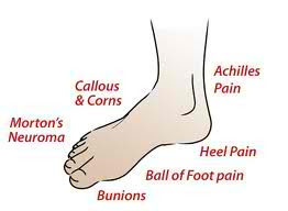 foot pain