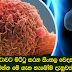 පිළිකාව නිට්‌ටාවට මට්‌ටු කරන සිංහල වෙදකමේ සැගවුන  රහස් මෙන්න මේ ගැන හැමෝම දැනුවත් වෙන්න.