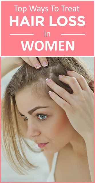 Top Ways To Treat Hair Loss in Women
