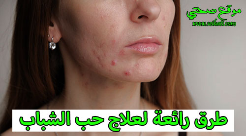 طرق رائعة لعلاج حب الشباب