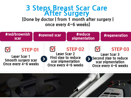 짱이뻐! - A To Z, Details Of Korea Breast Surgery Procedure