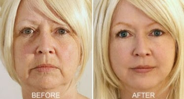9 Best Anti Aging Products For 30s Year Old Women [#Beauty]