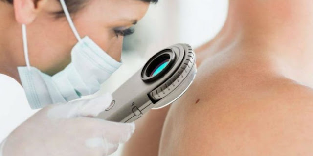 Global Dermatoscope Market