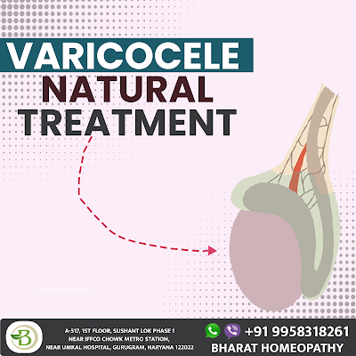 Varicocele Treatment By Homeopathy