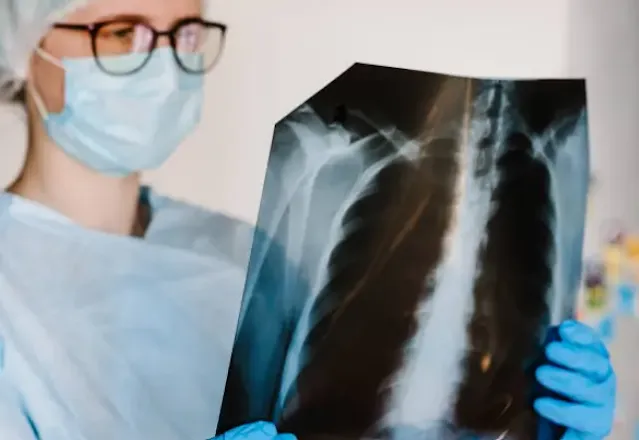 Acute Respiratory Distress Syndrome (ARDS): Causes, Symptoms, and Treatment