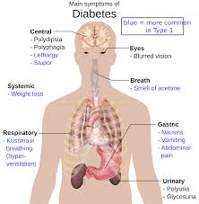 pengobatan diabetes secara alami