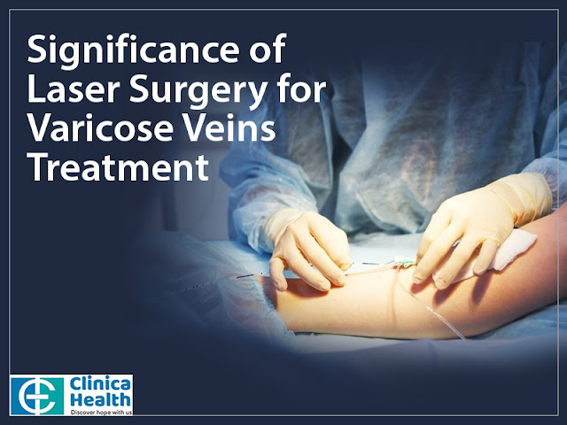 Laser surgery for varicose veins treatment