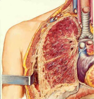 Mesothelioma Symptoms