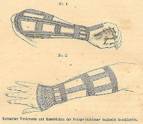 Pohnpei Arm Tattoo 1873