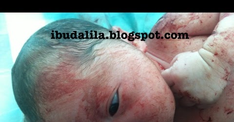 Ubat Sakit Mata Untuk Baby - Harbolnas e