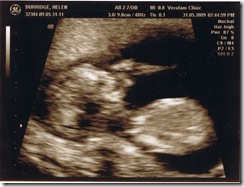 12 week scan 2