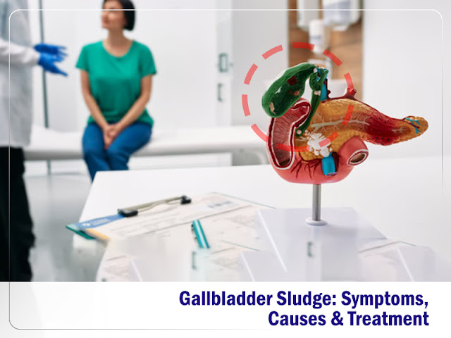 Gallbladder Sludge Symptoms, Causes