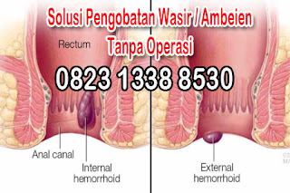 https://sediaobatwasir.blogspot.com/2019/08/obat-alami-kwalitas-khasiat-teruji.html