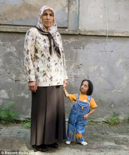 World's Shortest Girl @ http://smilecampus.blogspot.com