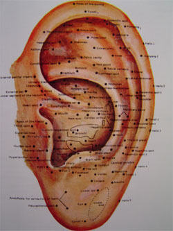 EAR MASSAGE - Tehnik Pijat Telinga untuk Menyembuhkan 