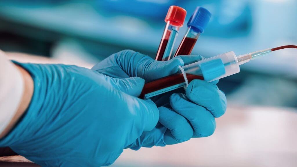 Light blue tube Phlebotomy Market Global Industry Insights, Trends, Outlook, and Opportunity Analysis, 2022-2028