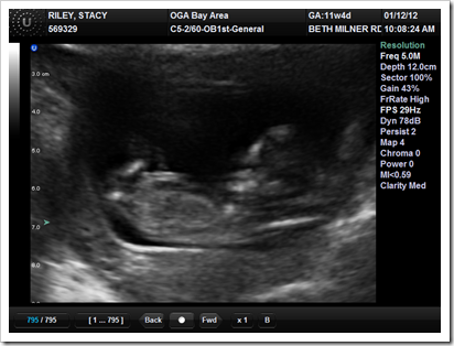 T3 First Photos 011