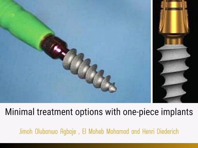 PDF: Minimal treatment options with one-piece implants