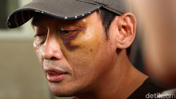 Kerap Didatangi Orang Asing, Relawan Jokowi Ninoy Karundeng Ajak Keluarga Tinggalkan Rumah