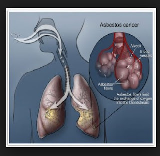 Asbestos Domicile Investigating Hindrance Is Exceed Than Cure