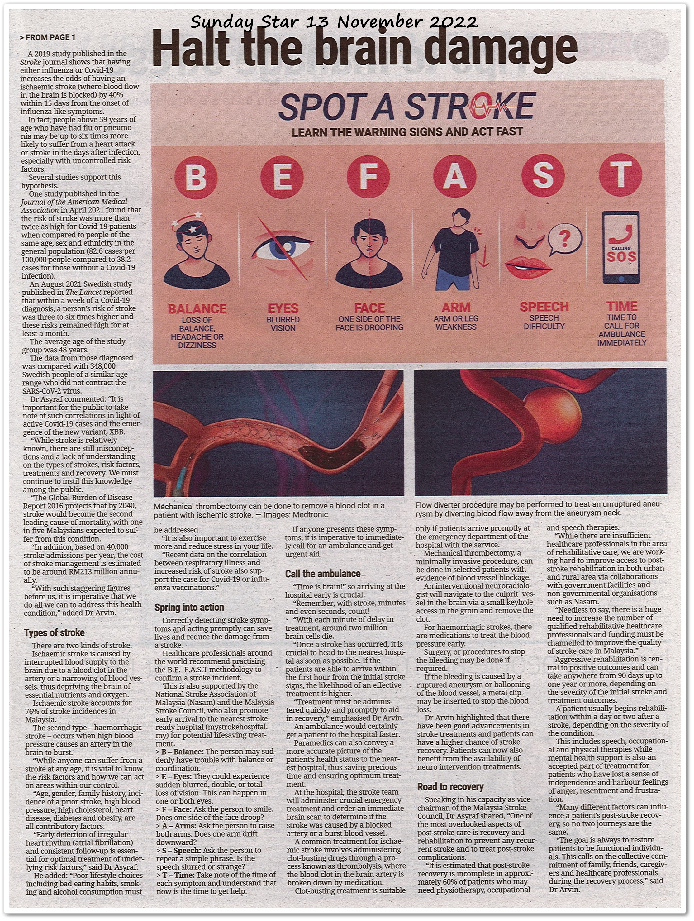 Strike out stroke, act F.A.S.T ; Halt the brain damage - Keratan akhbar Sunday Star 13 November 2022