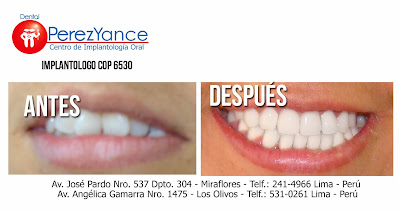  www.dentalperezyance.com